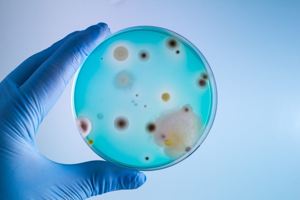 technician with bacterias sample in petri dish / Hands of doctor with petri plate in the laboratory