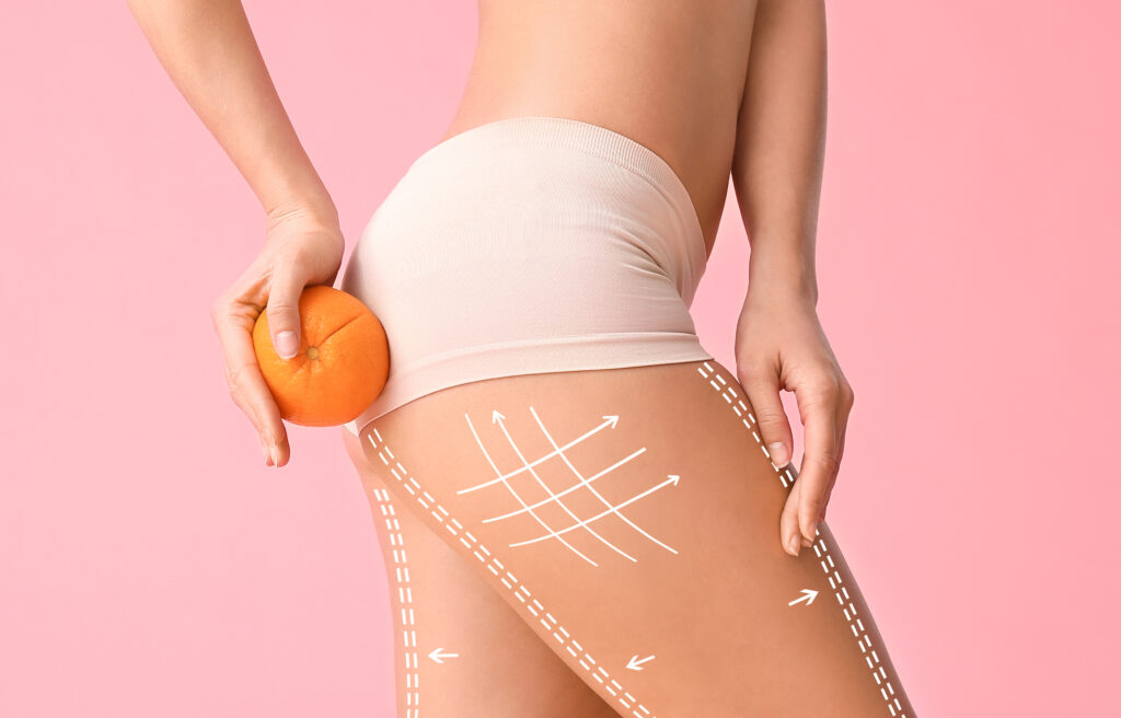 young woman with orange fruit on color background. concept of cellulite