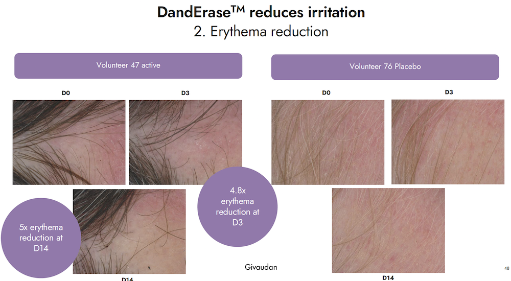danderase erythema reduction