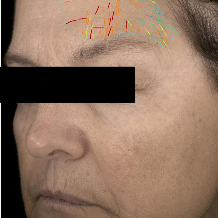 primalhyal ultrareverse focus on sleep wrinkles