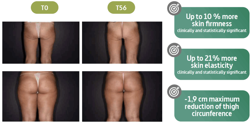 v3ds sculpt in vivo efficacy 1