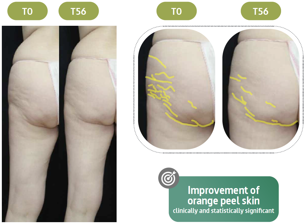 v3ds sculpt in vivo efficacy 2