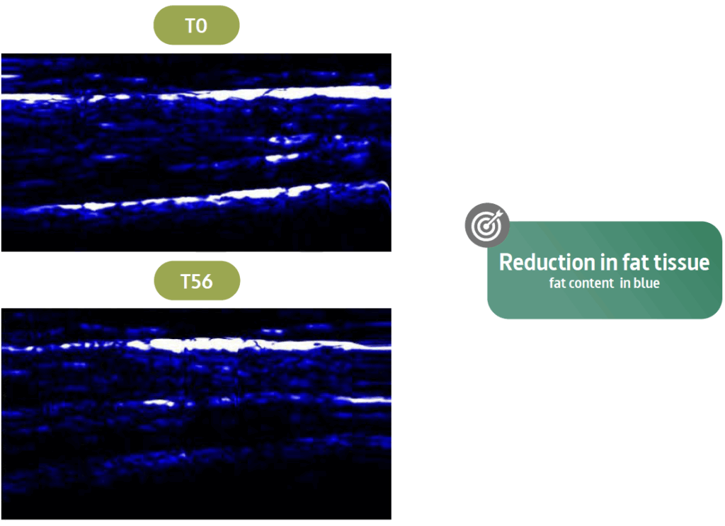 v3ds sculpt in vivo efficacy 4