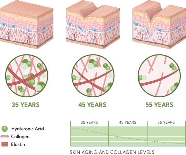 skin aging
