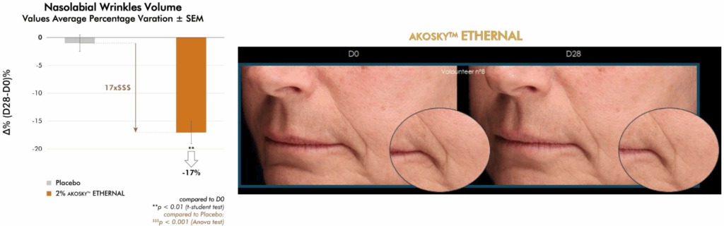 akosky ethernal clinical test nasolabial wrinkles