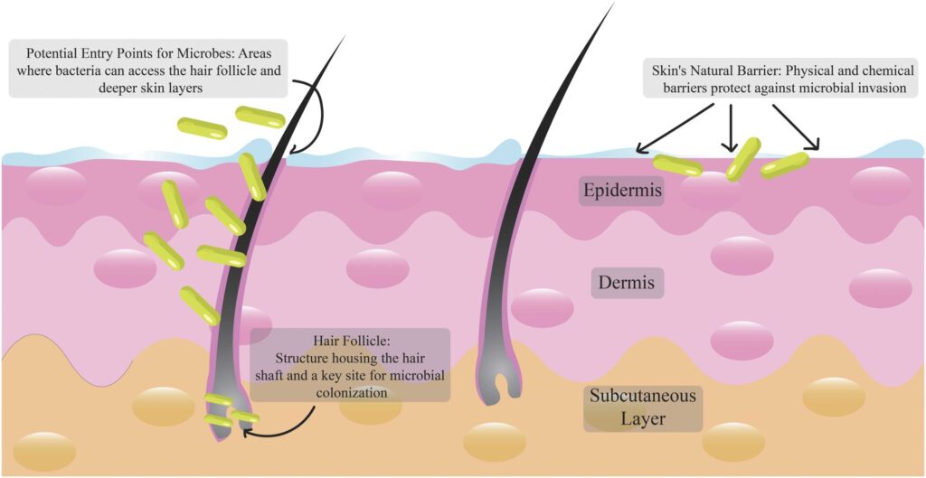 schematic representation of microbial colonization in the skin layers