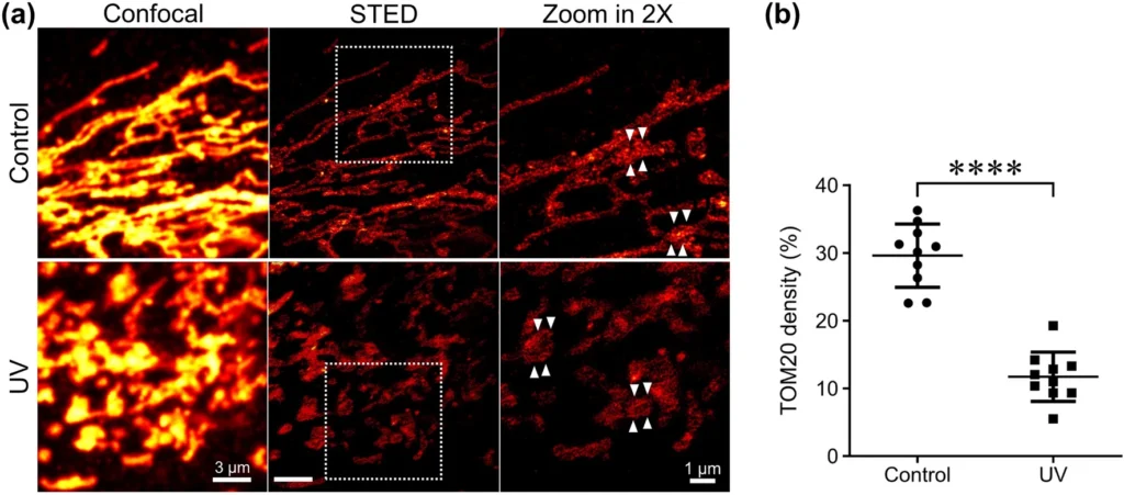 uv irradiation induces the distribution change of mitochondrial membrane proteins fig 1