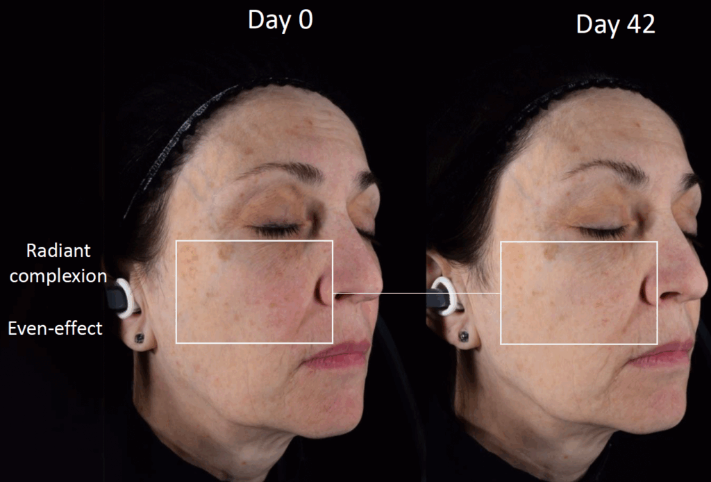 cutiguard clr even skin tone