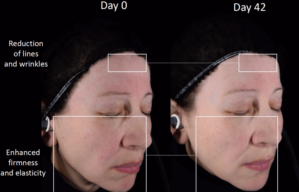 cutiguard clr refined texture 2