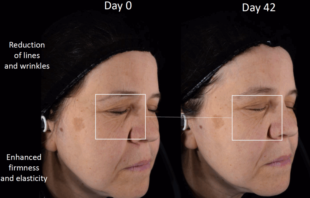 cutiguard clr refined texture 3