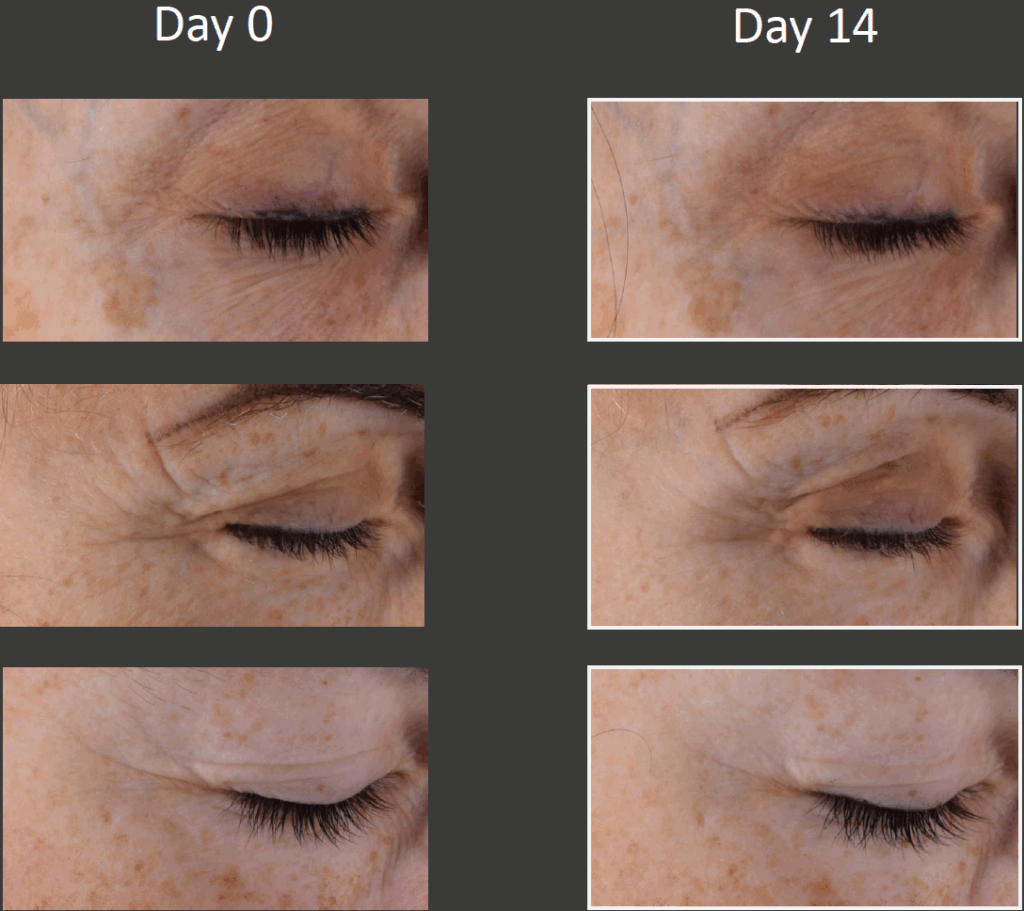 cutiguard clr refined texture 4