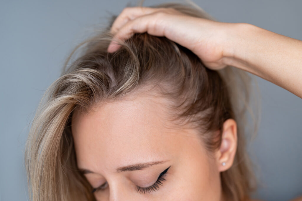 close up of young woman lifting her hair to reveal hairline and scalp. concept of hair loss, alopecia, thinning hair, hair care and healthy scalp on neutral background