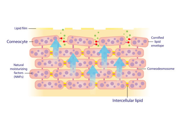 the mechanism of exfoliating corneocyte, skin cells vector isolated on white background. corneodesmosome degraded by enzymes, sebum barrier decreased. this allows bacteria to get in skin.