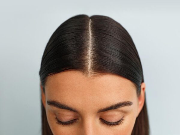 scalp picture